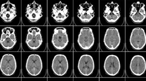 ¿Es verdad aquello de que estamos usando sólo una pequeña parte de nuestro cerebro?