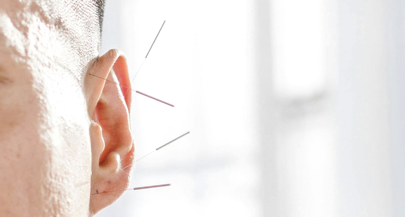 ¿Acupuntura y homeopatía sanan la enfermedad de Párkinson?